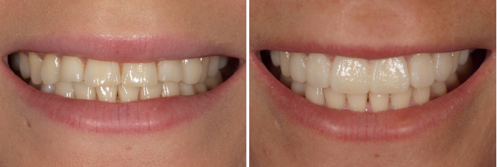 mockup-dental-prototipo-cursos-odontologia