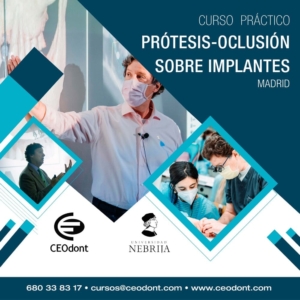 Curso protesis sobre implantes en Madrid